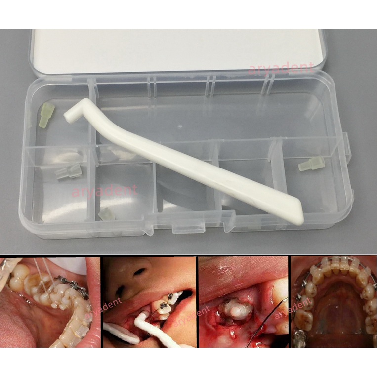 Dental Mini Orthodontic Mould Starter kit Injection Lingual Wire Button