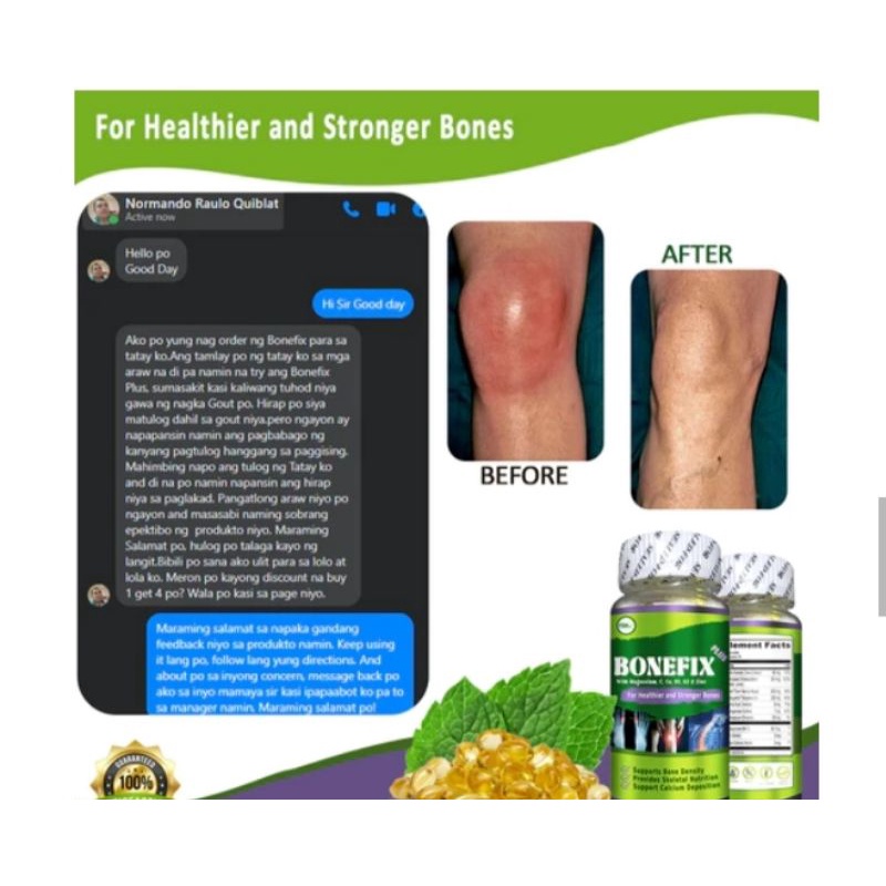 BONEFIX PLUS-for rheumatoid osteoarthritis | Shopee Philippines