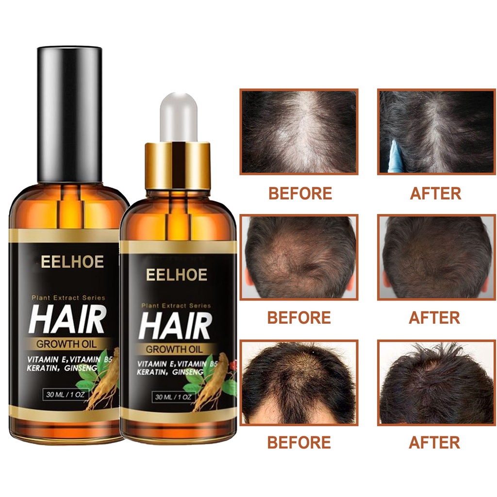 Hair Growth Essential Oil Serum Anti Hair Loss Spray Ginger Treatment