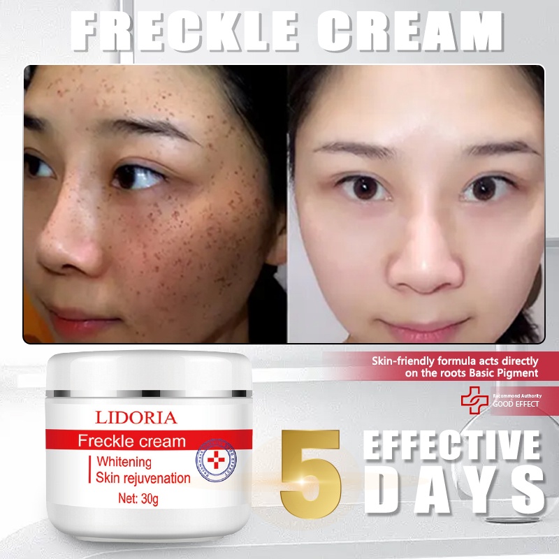 Melasma facial Cream pekas peka remover collagen japan original