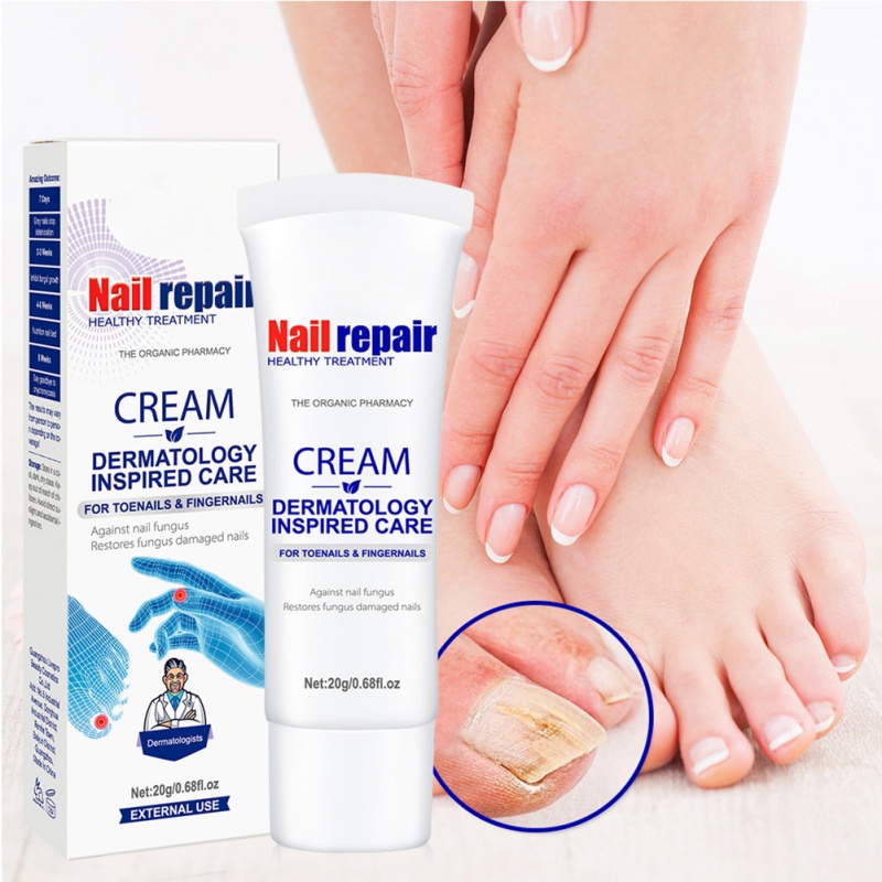 Nail Care Creams Antifungal Paronychia Treatment Serum Onychomycosis