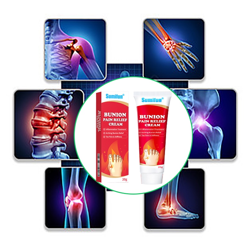 Arthritis Cream Arthritis Bunion Pain Relief Gout Ointment Treatment Joint Knee Pain Toe Finger