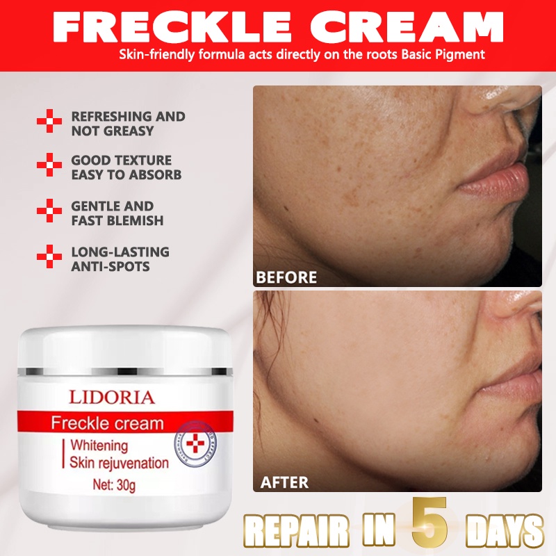 Jekina Melasma Remover Pangea Scar Serum Original Kasumi Abera Melasma