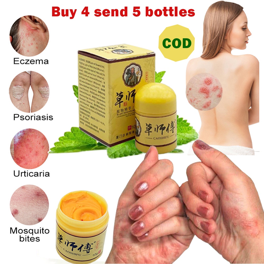 Y08【Ready Stock】CAOSHIFU Psoriasis Eczema Cream Anti Fungal Cream Itchy