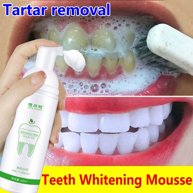 Teeth whitening mousse toothpaste Remove Tartar Remove Plaque Oral Odor