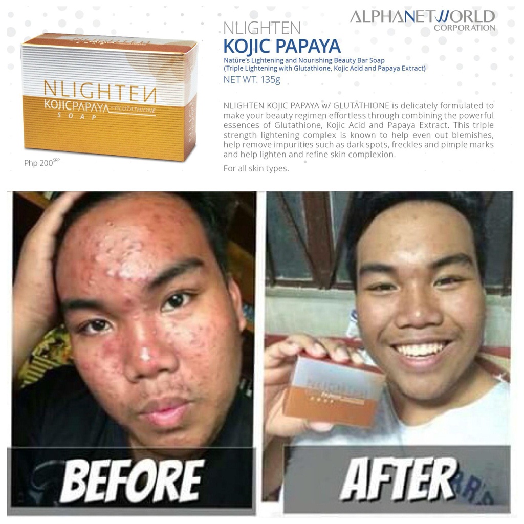 NLIGTHEN KOJIC PAPAYA WITH GLUTATHIONE SOAPS 3 packs Anti Pimple Acne) Shopee Philippines