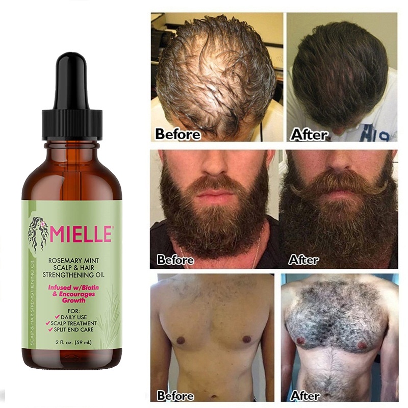 Mielle Organics Rosemary Mint Scalp and Hair Strengthening Oil, infused ...