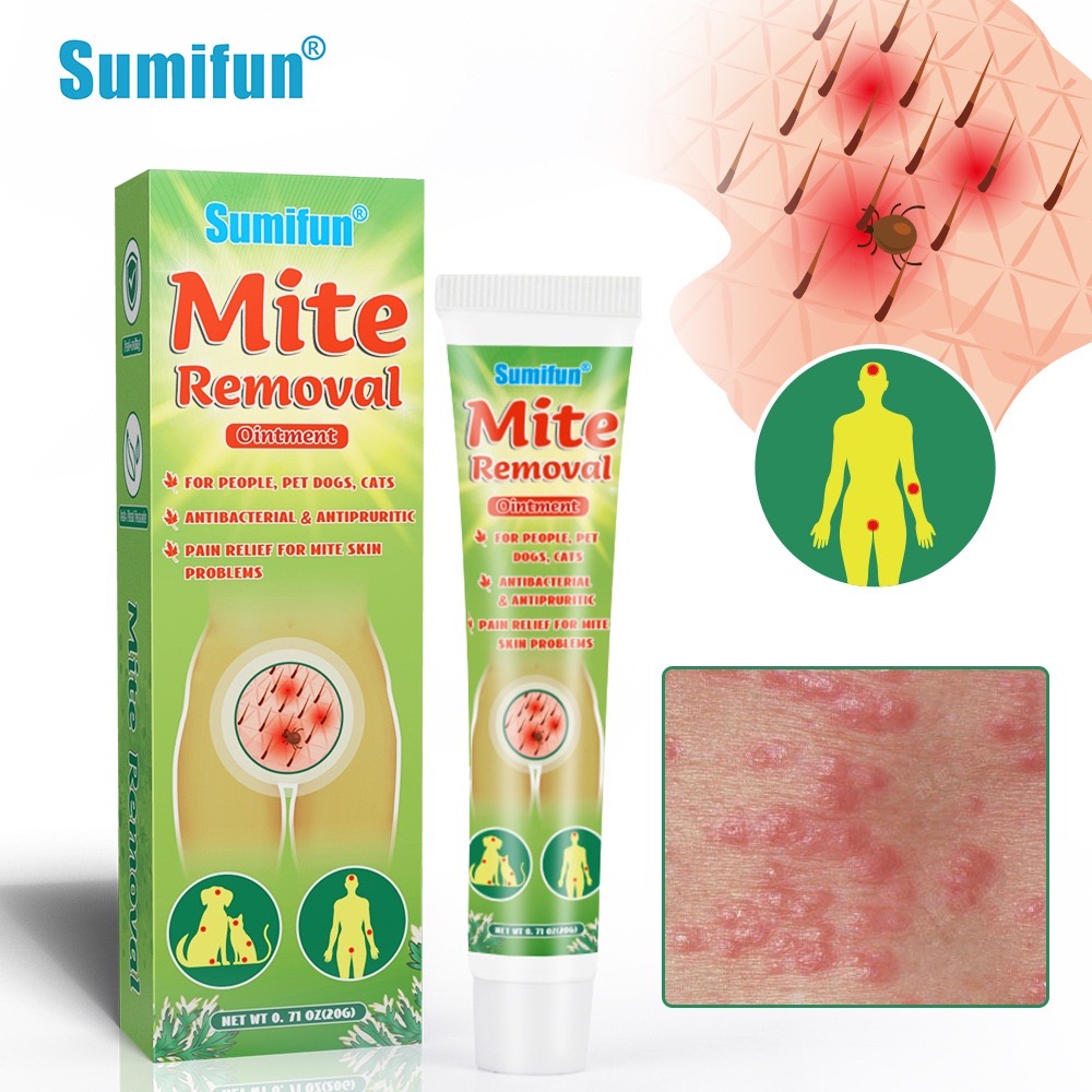 Mites Removal Cream Anti Itch Cream Antibacterial Ointment AntiItching