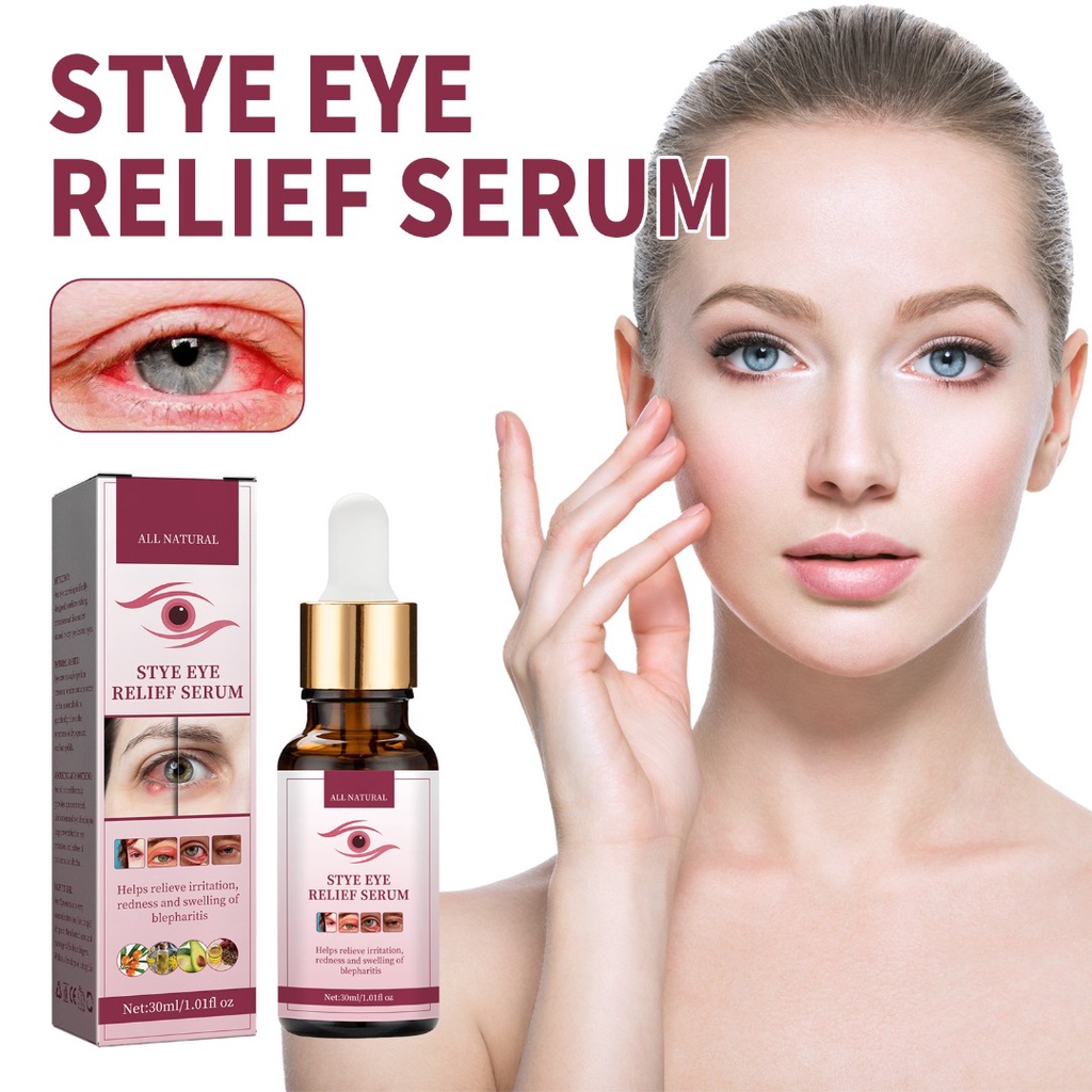 Stye Eye Relief Serum for Styes Chalazion Blepharitis Treatment Gentle