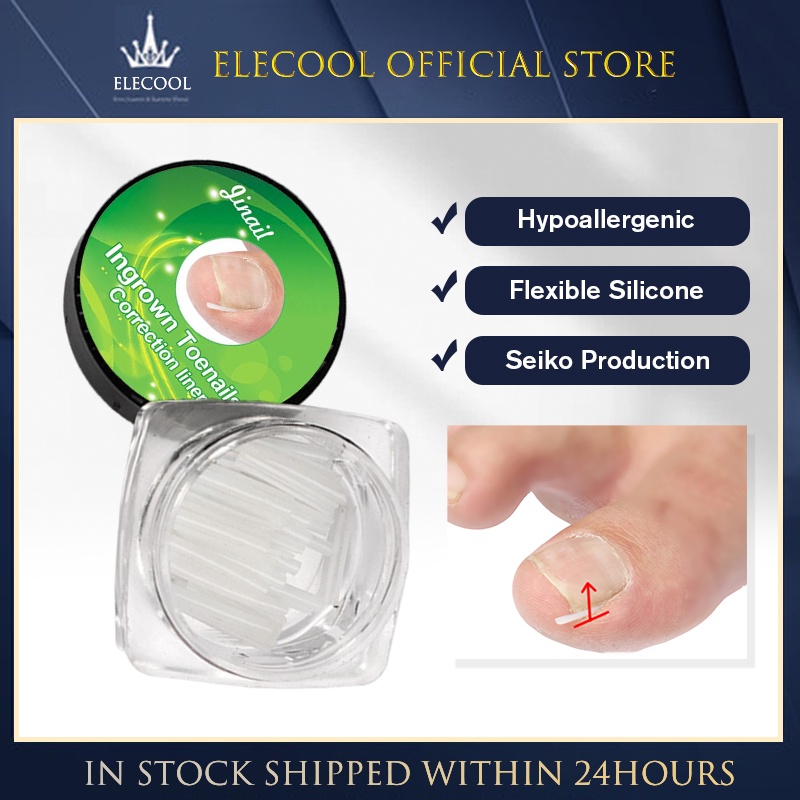 10PCS/Set Ingrown Nail Pad Groove Ortho Foot Care Tool Toenail