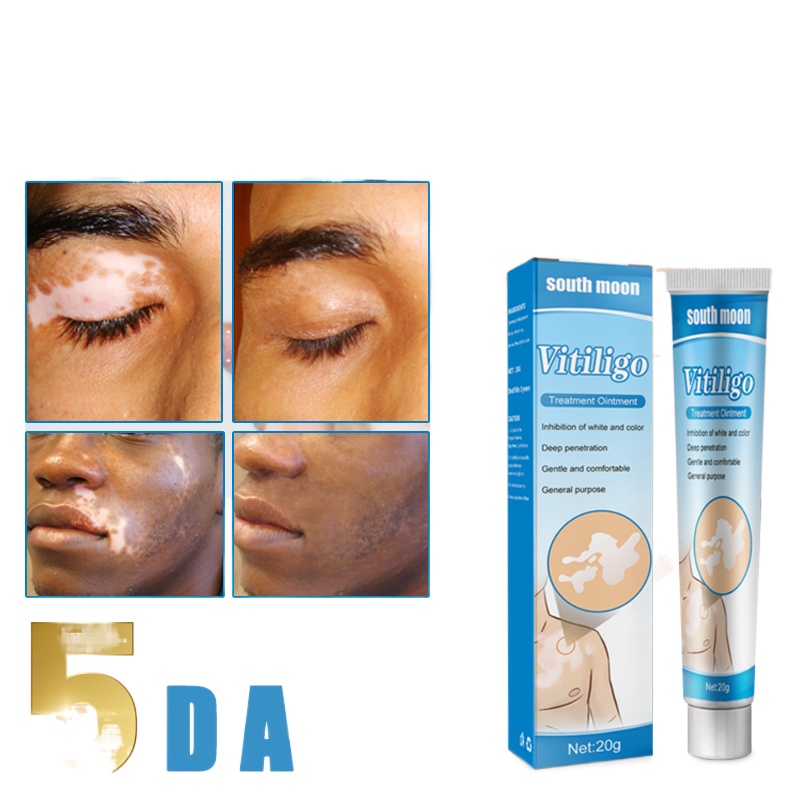 vitiligo skin treatment cream vitiligo remover derma cream for white