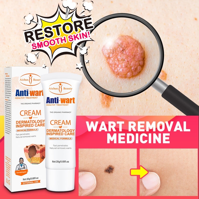 Genital Warts Remover Wart Removal Ointment Acne Gel Body Wart