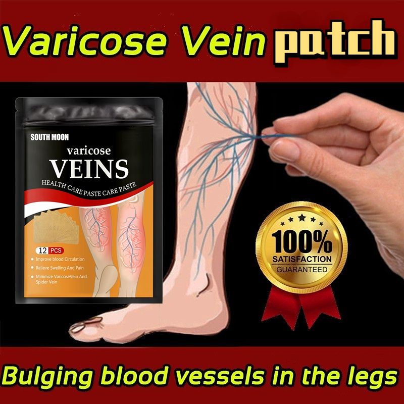Effective Varicose Vein and Spider Vein Minimizer Patch Improve Blood ...