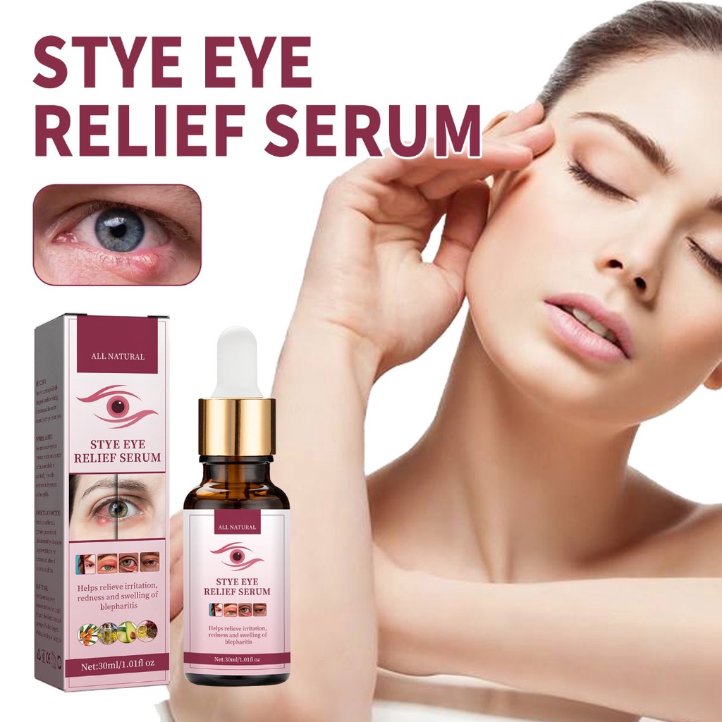 Stye Eye Relief Serum for Styes Chalazion Blepharitis Treatment Gentle