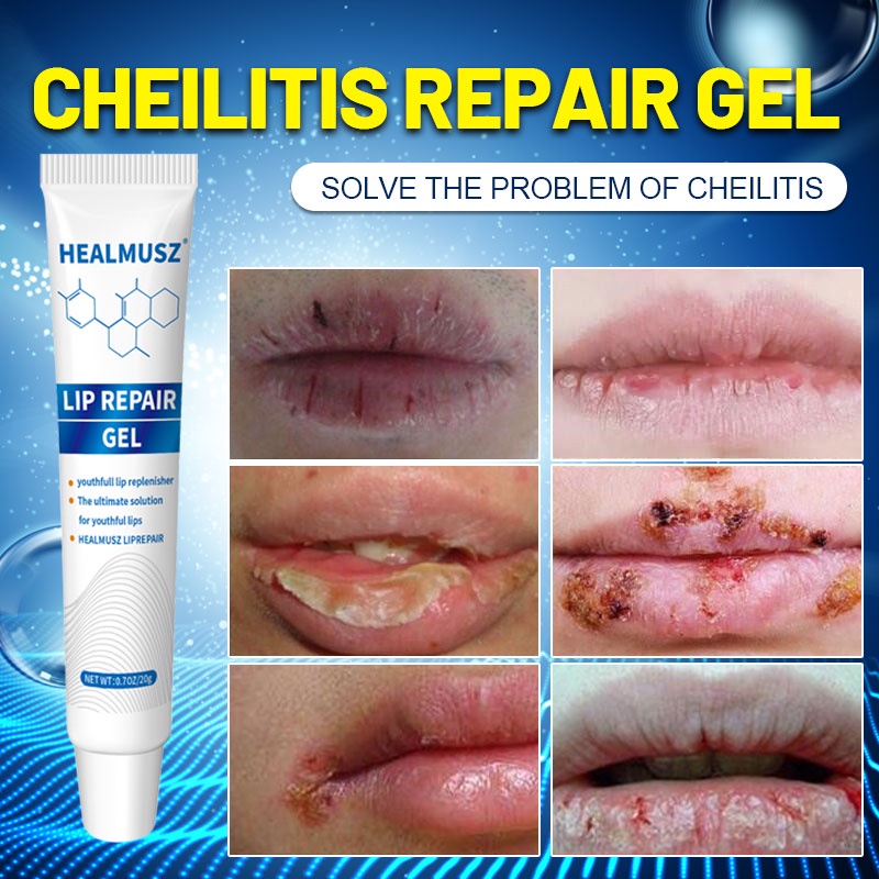 Lip care cheilitis repair gel lip balm moisturizing and moisturizing