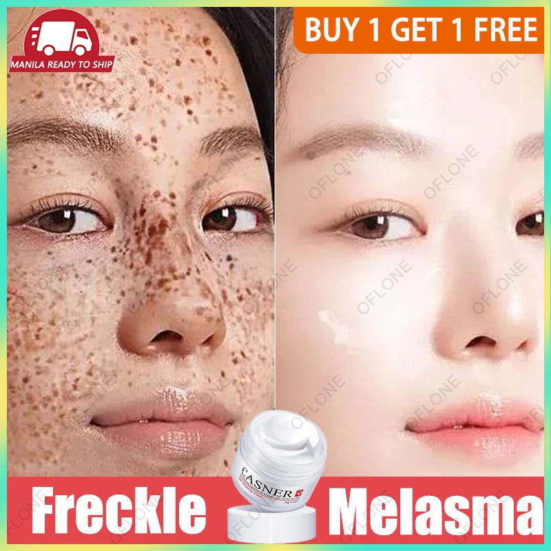 Support COD Buy 1 Take 1 Cream For Face Whitening Freckle Melasma