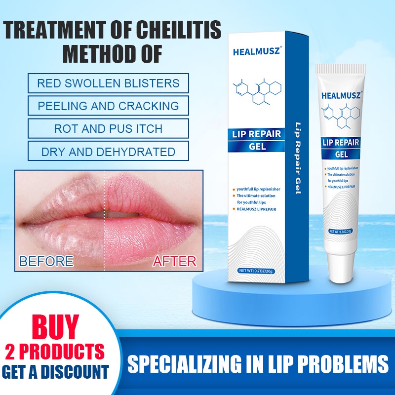 Cheilitis lip balm repairs chapped lips peeling moisturizing