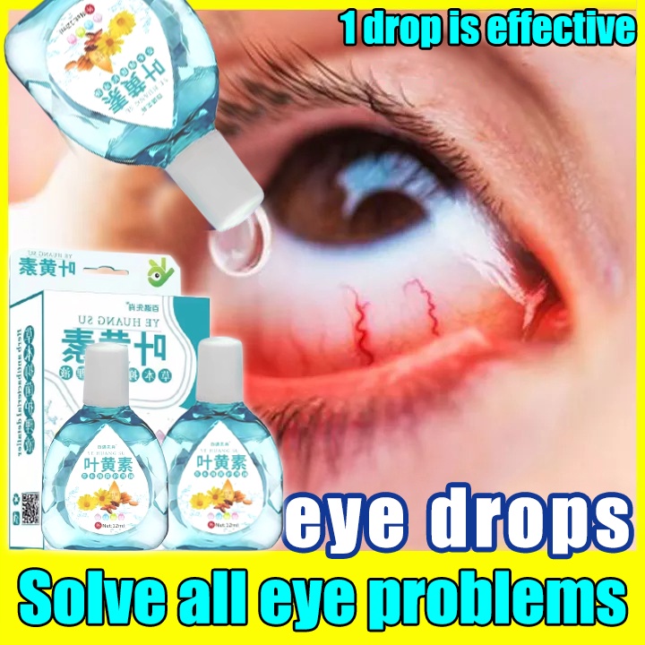 30ml rohtoz /visine/cmd/bioline eye drops contact lens eye care for dye