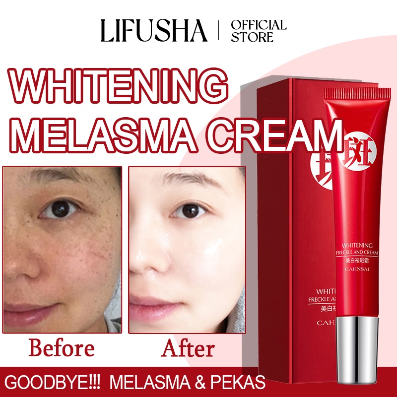 LIFUSHA Melasma Remover Cream Collagen Pekas Remover Original Dark Spot ...