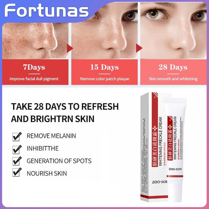 Effective Freckle Cream Remove Dark Spots Witening Cream Fade Acne 