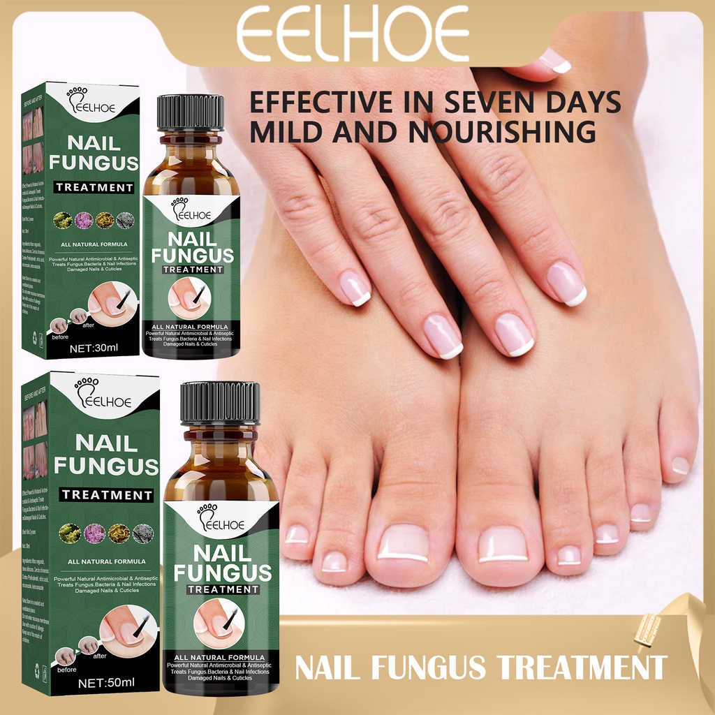 EELHOE Nail Fungus Treatment Spray Repair Serum Solution Cream ...