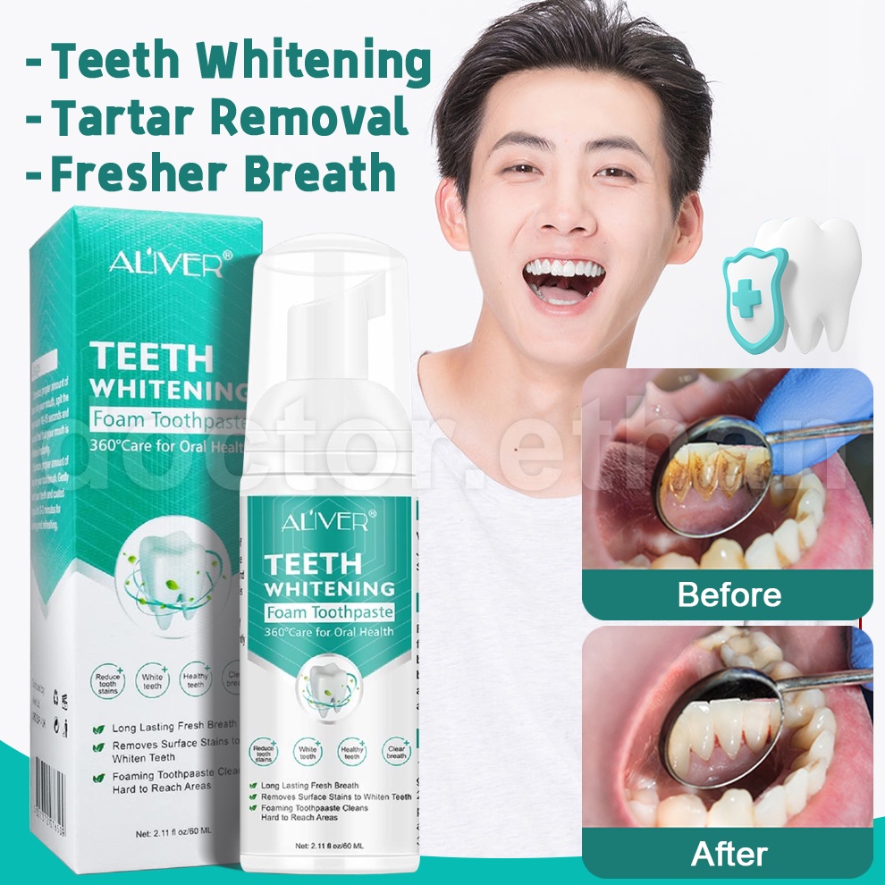 ALIVER Teeth Whitening Mousse Toothpaste Tartar Removal for Teeth Plaqu ...