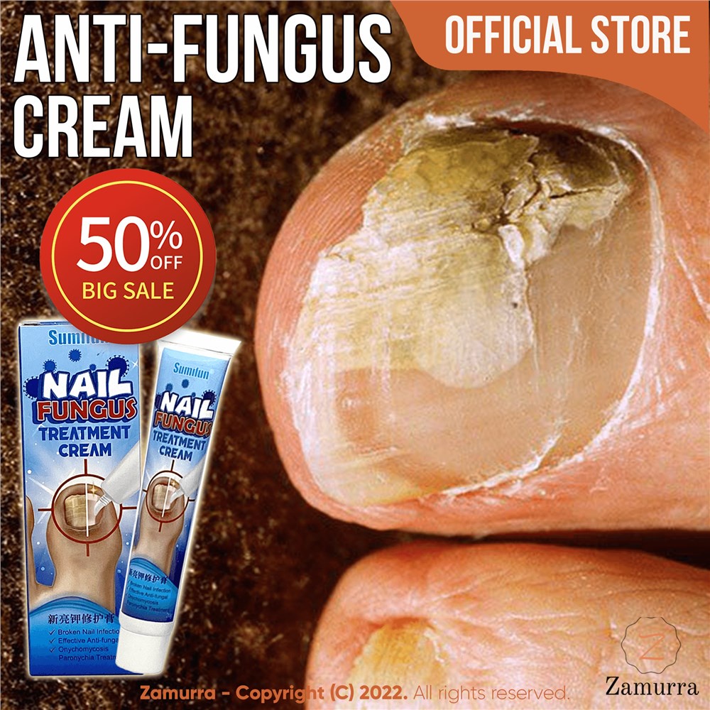 Effective AntiFungal SUMIFUN Nail Fungus Treatment Cream Nail