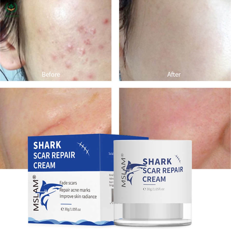 YJ Shark Scar Repair Cream Scar Removal Cream Reduce Scar Area Fade