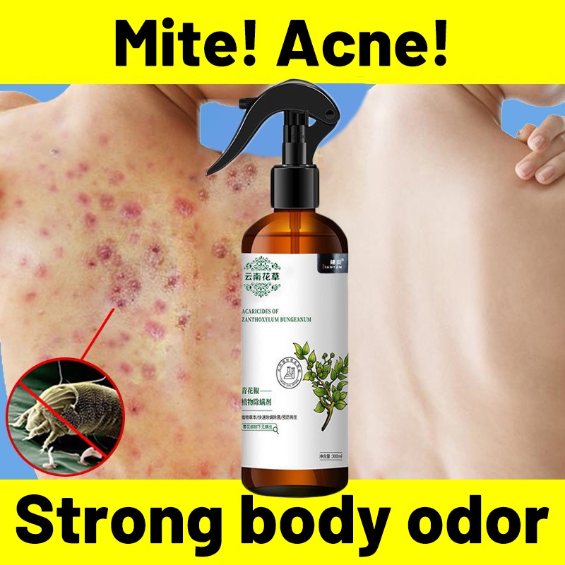 300ML Mite Spray Bed Bug Killer Dust Mite Remove Spray Nontoxic