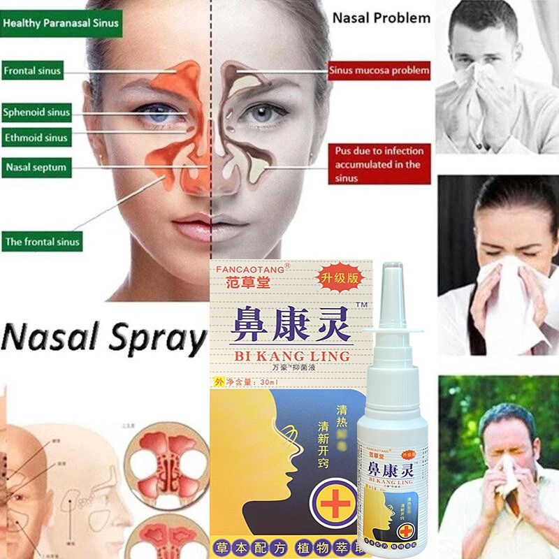 YANJIAYI 30ML Sinusitis Spray Nasal Spray Chronic Allergic Rhinitis