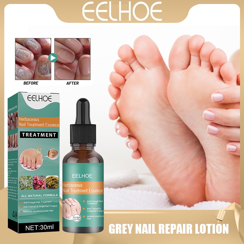 EELHOE Nail Fungus Treatment Original Natural Onychomycosis Remover