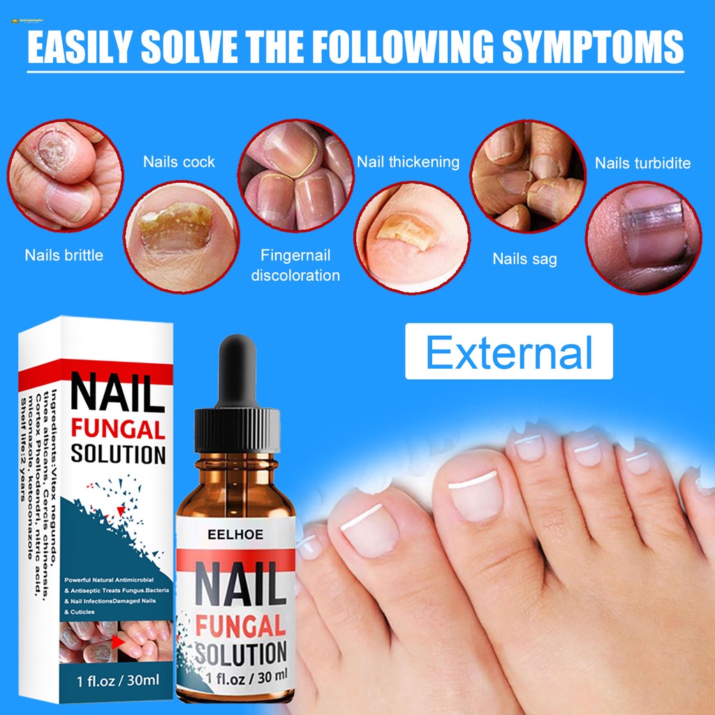 EELHOE nail repair liquid hand and foot onychomycosis care repair