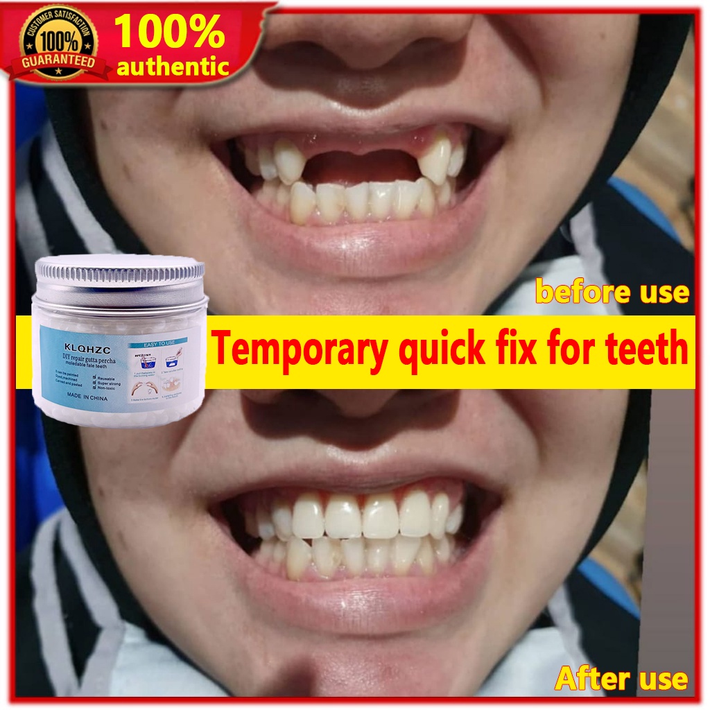 Teeth Restoration 50g Dentures veneers temporary teeth temporary