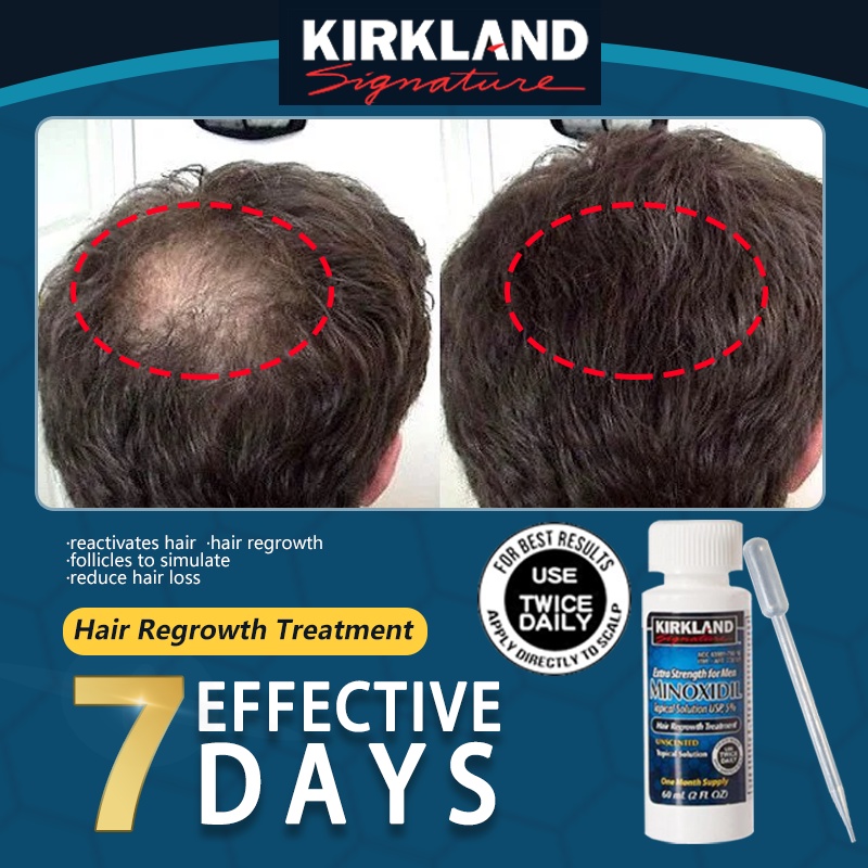 hair grower for man and woman minoxidil hair grower original hair ...