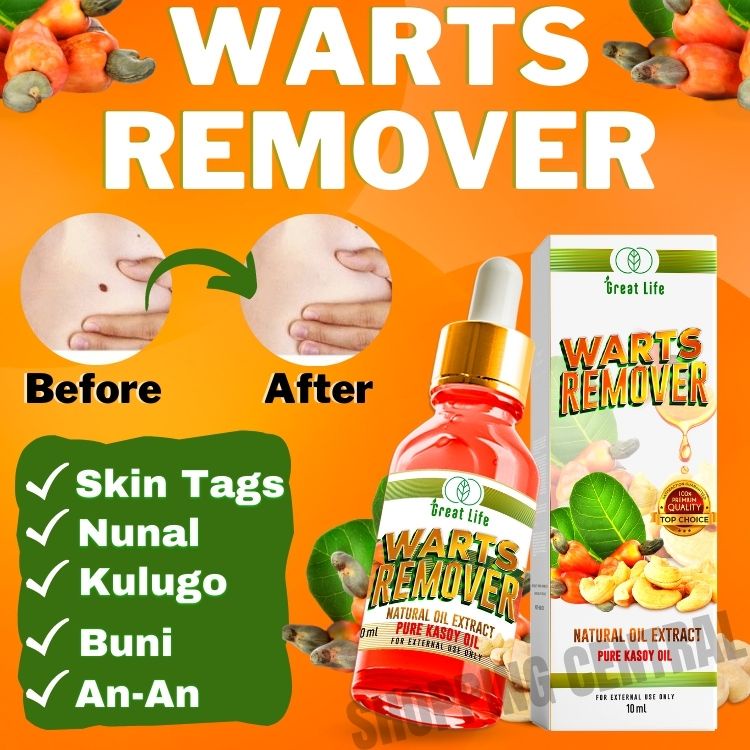 Warts Kasoy Remover Cream Skin Tag Mole Cream Remover Original Warts ...