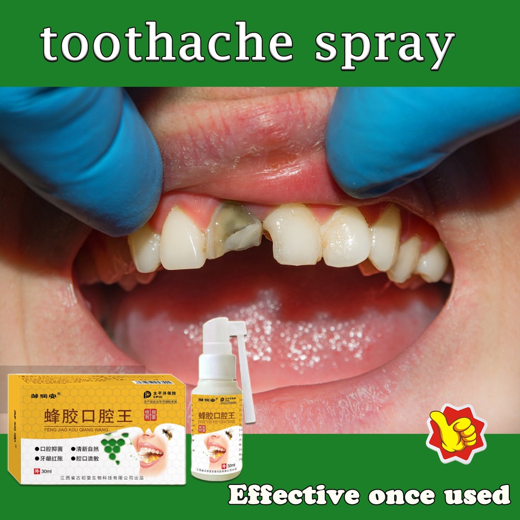 Toothache oral spray toothache reliever toothache pain relief teeth