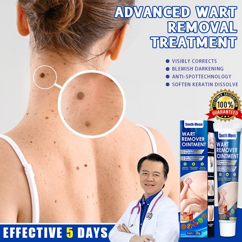 warts remover original warts removal skin tag remover original kasoy ...