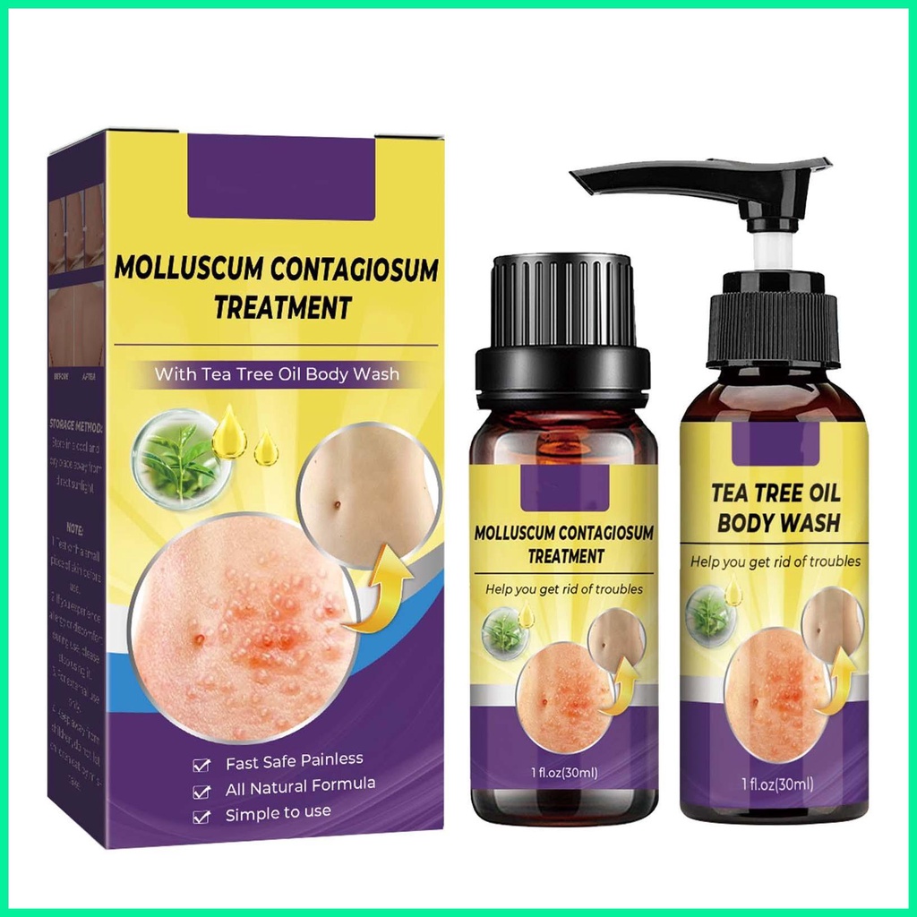 Wart Remover Molluscum Shower Gel And Molluscum Liquid Molluscum Contagiosum Solution & Tree