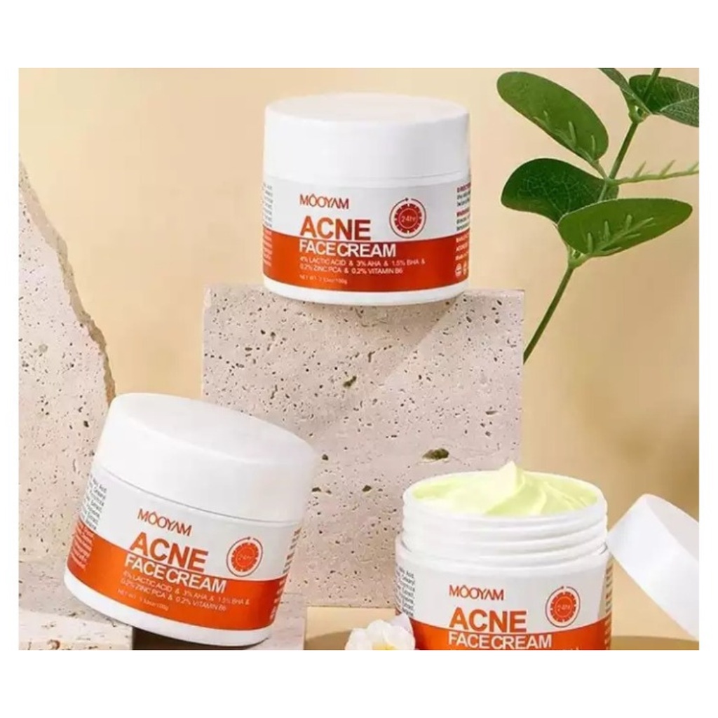 Mooyam Acne Face Cream 100g Shopee Philippines