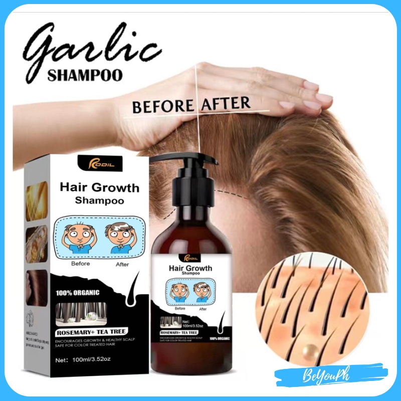 RODIL Garlic Shampoo Herbal Essence Anti Dandruff Shampoo, Anti Hair ...