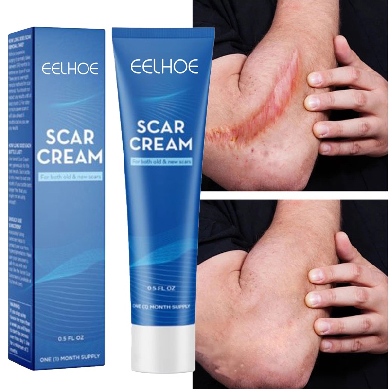 EELHOE Acne Scar Removal Cream Gel Skin Care Stretch Marks Remove Acne