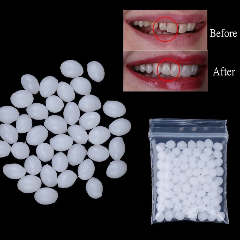 5g 25g Temporary Tooth Repair Kit Teeth and Gaps FalseTeeth Solid Glue Denture Adhesive Vampire