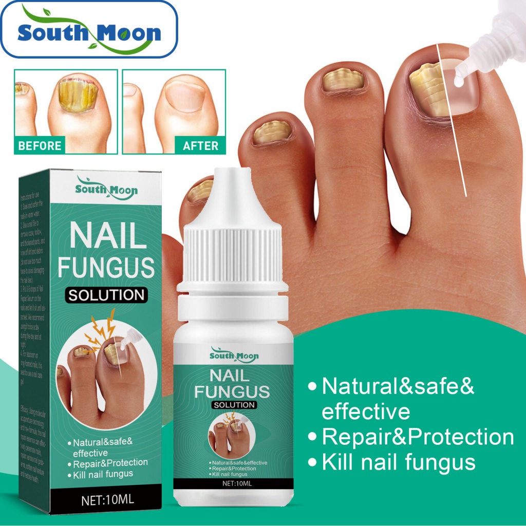 South Moon Nail Fungus Solution Treatment Essence Serum Hand & Foot ...