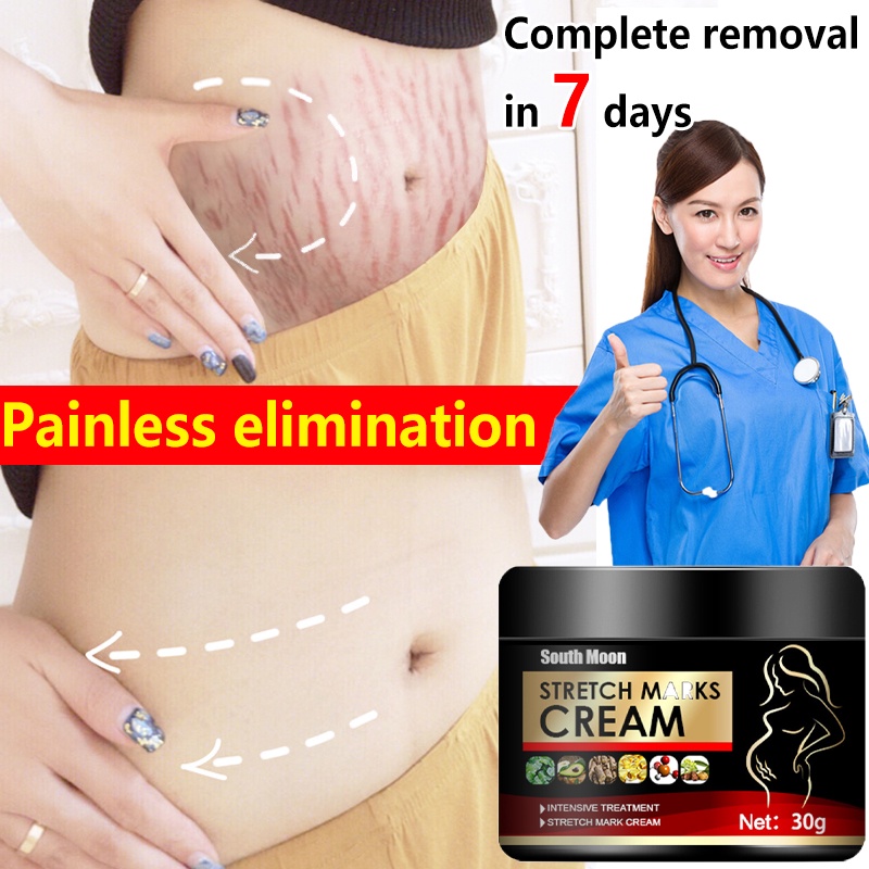 Stretch mark cream 30ml Remover stretchmarks Stretch mark removal ...