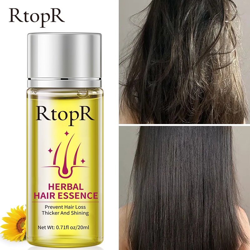 RtopR Hair Growth Essence Anti Hair Loss Liquid Promote Thick Fast Hair
