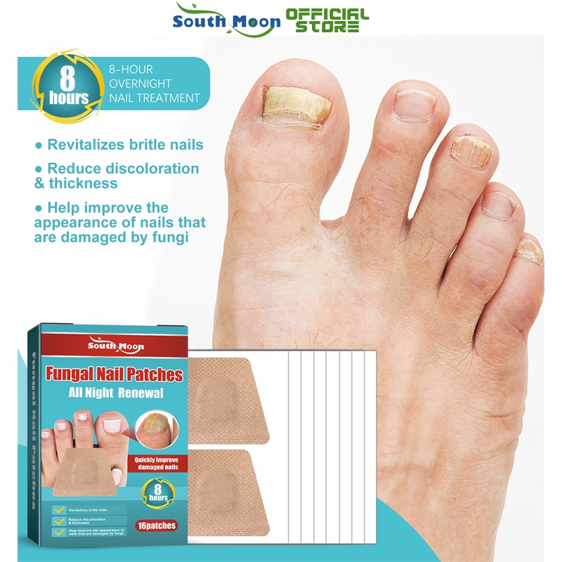 South Moon Fungal Nail Patches Antibacterial Nail Treatments