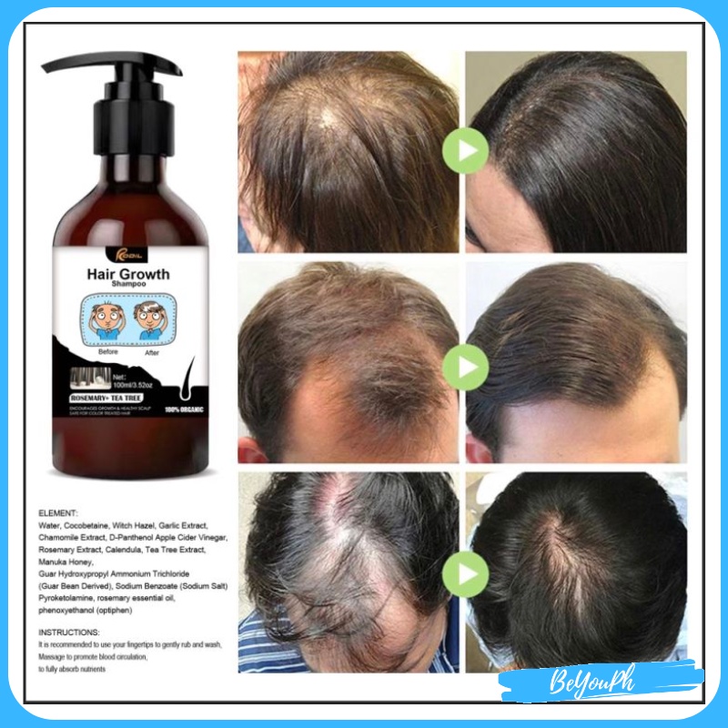 RODIL Garlic Shampoo Herbal Essence Anti Dandruff Shampoo, Anti Hair ...