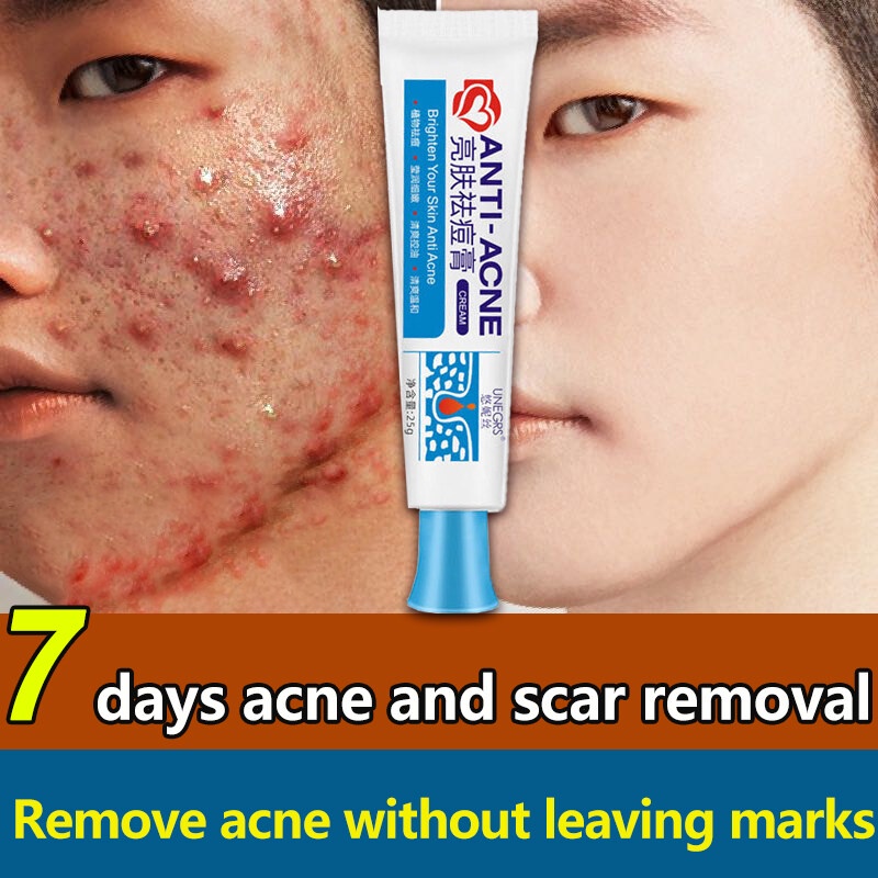 anti-acne-cream-acne-treatment-gel-pimple-scars-remover-repair-comedone