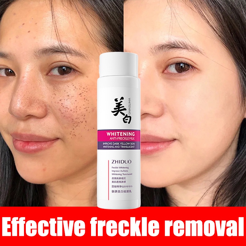 ML Whitening Freckle Cream Nicotinamide Moisturizing Dark Spots Remover Freckle Milk Lotion