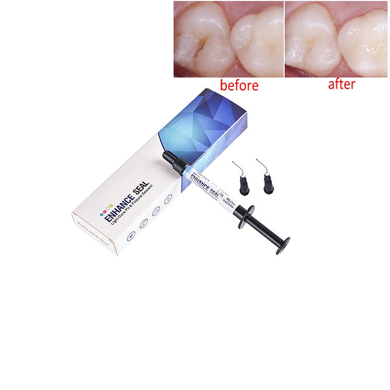Prime Light-Cure Composite Surface Sealant, 7 Ml Bottle - Dental Restoration Use 4 thumbnail image